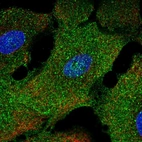 Immunofluorescent staining of human cell line A549 shows localization to plasma membrane & cytosol.