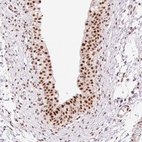 Anti-PRDM11 Antibody