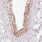 Anti-PRDM11 Antibody