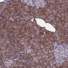 Anti-WBP1 Antibody