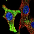 Immunofluorescent staining of human cell line A549 shows localization to cytosol.