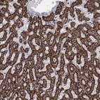 Anti-GCSH Antibody