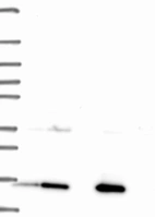 Lane 1: Marker [kDa] 250, 130, 95, 72, 55, 36, 28, 17, 10 | Lane 2: RT4 | Lane 3: U-251 MG | Lane 4: Human Plasma | Lane 5: Liver | Lane 6: Tonsil