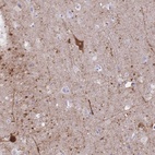 Anti-GRB7 Antibody