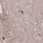 Anti-GRB7 Antibody