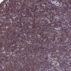 Anti-TNFAIP8 Antibody