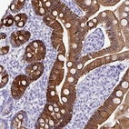 Immunohistochemical staining of human duodenum shows moderate cytoplasmic and membranous positivity in glandular cells.