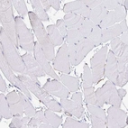 Immunohistochemical staining of human skeletal muscle shows no positivity in myocytes as expected.