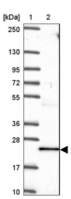 Lane 1: Marker [kDa] 250, 130, 95, 72, 55, 36, 28, 17, 10_br/_Lane 2: Human cell line RT-4