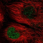 Immunofluorescent staining of human cell line A-431 shows localization to nucleoplasm.