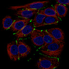 Anti-CLDN3 Antibody