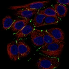 Immunofluorescence staining of MCF-7 cells using the Anti-CLDN3 monoclonal antibody, showing specific staining in cell junctions in green. Microtubule- and nuclear probes are visualized in red and blue, respectively (where available).