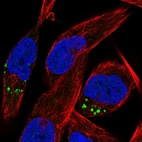 Immunofluorescent staining of human cell line RH-30 shows localization to vesicles.