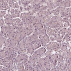 Immunohistochemical staining of human pancreas shows low expression as expected.