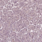 Immunohistochemical staining of human pancreas shows low expression as expected.