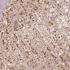 Immunohistochemical staining of human adrenal gland shows high expression.