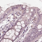 Immunohistochemical staining of human colon using Anti-SAT2 antibody HPA057096.
