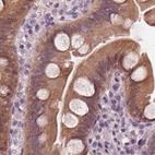 Immunohistochemical staining of human small intestine using Anti-SAT2 antibody HPA057096.