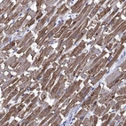 Immunohistochemical staining of human Heart muscle shows strong cytoplasmic positivity in cardiomyocytes.
