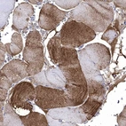Immunohistochemical staining of human Skeletal muscle shows moderate cytoplasmic positivity in myocytes.