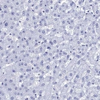 Immunohistochemical staining of human Liver shows very weak cytoplasmic positivity in hepatocytes.