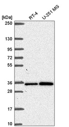 Anti-GEMIN2 Antibody