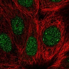 Anti-GEMIN2 Antibody