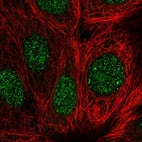 Immunofluorescent staining of human cell line MCF7 shows localization to nucleus, nucleoli & nuclear bodies.