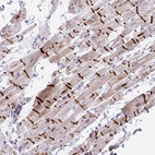 Anti-TMEM86A Antibody