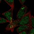 Immunofluorescent staining of human cell line RH-30 shows localization to nucleoplasm & the Golgi apparatus.