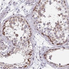 Anti-ZNF778 Antibody