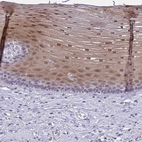 Immunohistochemical staining of human esophagus shows high expression.
