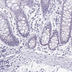 Immunohistochemical staining of human colon shows low expression as expected.