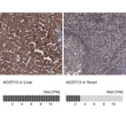 Anti-ACOT13 Antibody