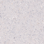 Immunohistochemical staining of human cerebral cortex shows no positivity in neurons as expected.