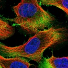 Immunofluorescent staining of human cell line U-2 OS shows localization to plasma membrane.