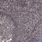 Immunohistochemical staining of human tonsil shows low expression as expected.