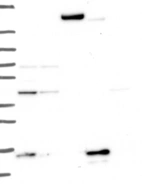 Lane 1: Marker [kDa] 250, 130, 95, 72, 55, 36, 28, 17, 10 | Lane 2: RT4 | Lane 3: U-251 MG | Lane 4: Human Plasma | Lane 5: Liver | Lane 6: Tonsil