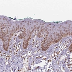 Immunohistochemical staining of human Skin shows moderate positivity in nuclear membrane in squamous epithelial cells.