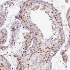 Immunohistochemical staining of human Testis shows moderate positivity in nuclear membrane in cells in seminiferous ducts and Leydig cells.