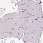 Immunohistochemical staining of human Skeletal muscle shows moderate positivity in nuclear membrane in myocytes.