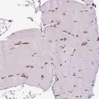 Immunohistochemical staining of human Skeletal muscle shows moderate positivity in nuclear membrane in myocytes.