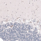 Immunohistochemical staining of human cerebellum shows no positivity in Purkinje cells as expected.