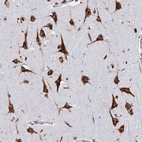 Anti-RFK Antibody