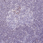 Anti-ETNK2 Antibody