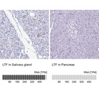 Anti-LTF Antibody