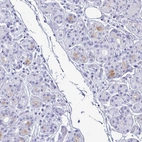 Immunohistochemical staining of human salivary gland shows high expression.