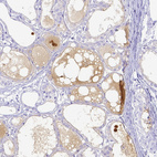 Immunohistochemical staining of human lactating breast shows plasma positivity.
