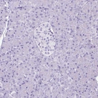 Immunohistochemical staining of human pancreas shows low expression as expected.