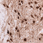 Anti-SLC18A2 Antibody